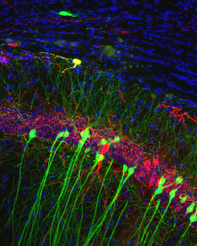 Hippocampal neurons