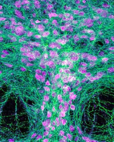 Brain Paradox